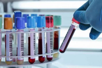 The Blood Sample